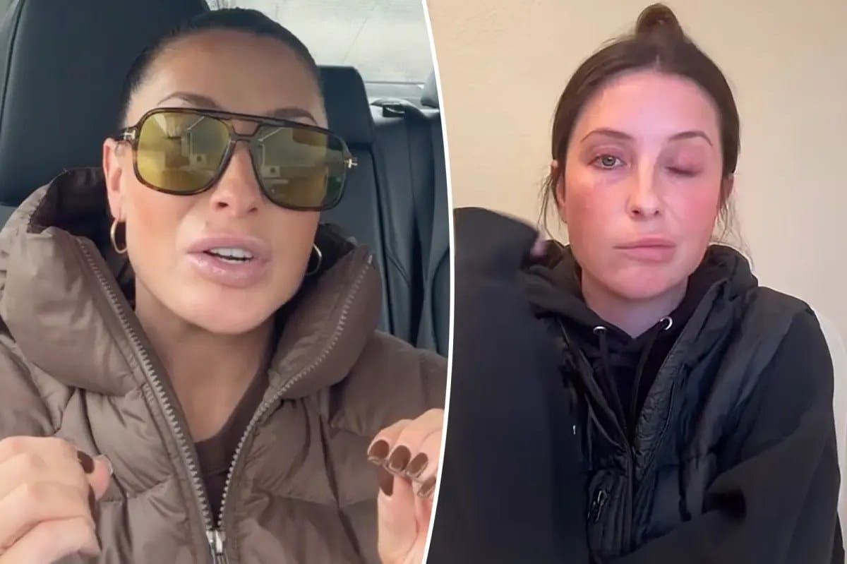 Bristol Palin says facial paralysis brought confidence, deeper faith and healthier life — Pagesix.com