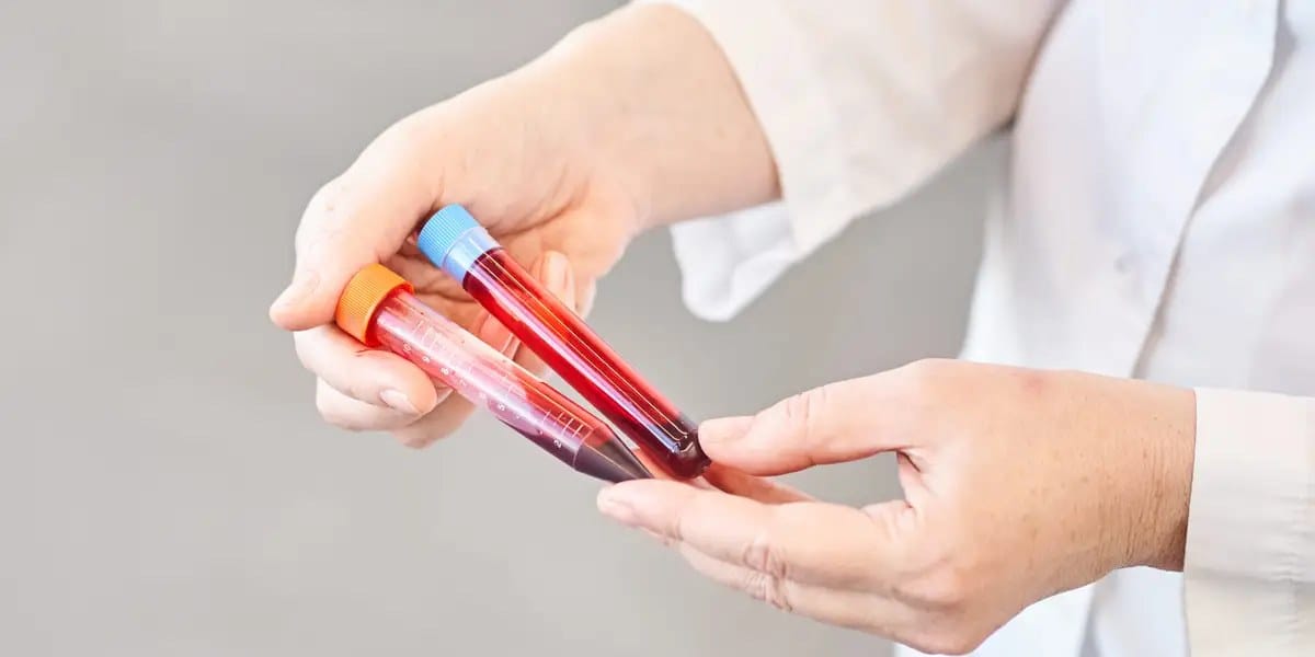 Grail's $700 blood test screens 50 cancers but misses many early cases — Businessinsider