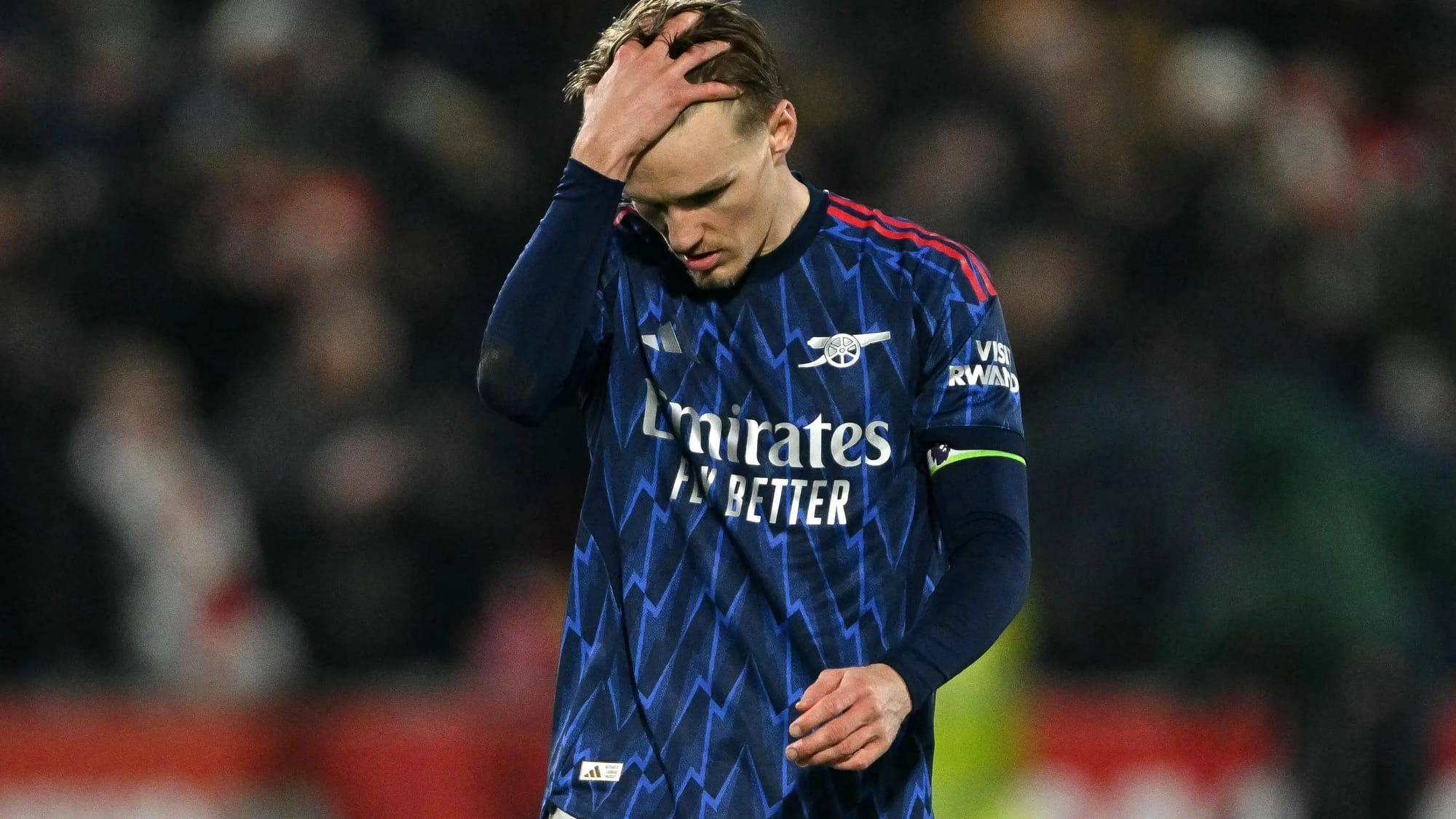 Arteta explains Odegaard absence and confirms two new injury concerns — Goal