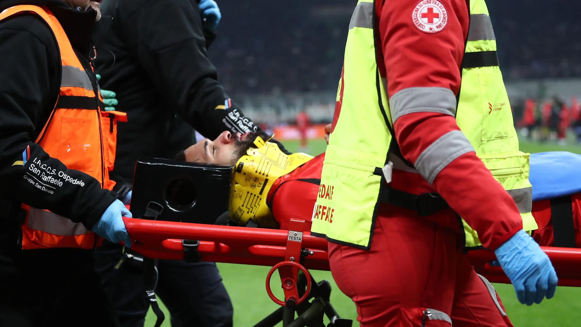 Ruben Loftus-Cheek to undergo surgery after alveolar bone fracture — Goal