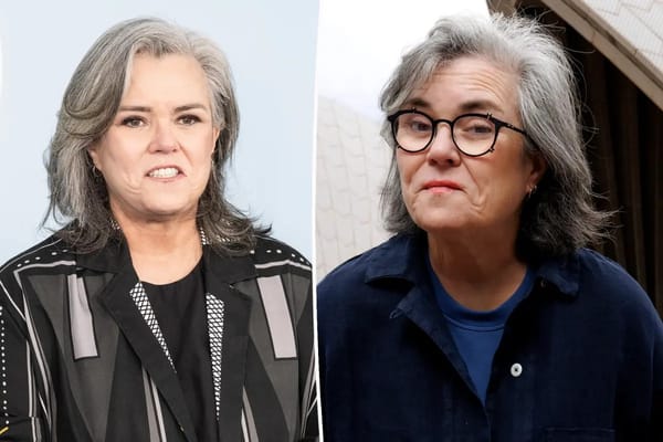 Rosie O'Donnell describes comments that prompted her facelift — Pagesix