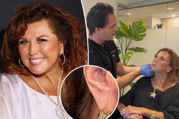 Abby Lee Miller shows off 'amazing' $1K ear rejuvenation results — Pagesix