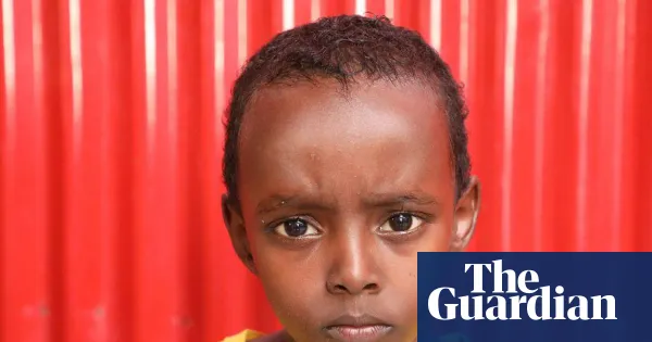 Seven-year-old risks losing ability to walk after US airstrike in Somalia — World news | The Guardian