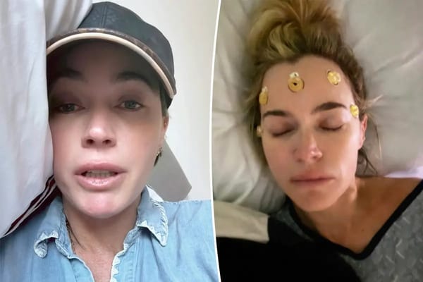 Teddi Mellencamp gives rare update on what 'cancer recovery looks like' — Pagesix