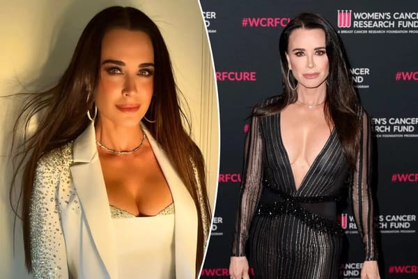 Kyle Richards says on-sale Medicube masks make her skin 'look like glass' — Pagesix